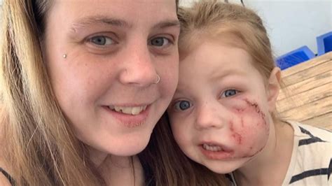 Mother of girl, 4, mauled by XL bully crossbreed 'glad' they will be ...