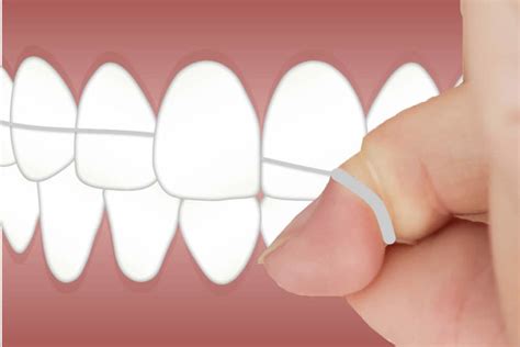 Dental Glue For Teeth. How To DIY Repair Crown, Bridge or Retainer? | SayEducate Money ...