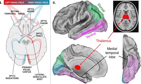 Some people can't see, but still think they can: here's how the brain controls our vision