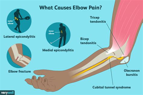 Elbow Pain: Causes, Treatment, and When to See a Healthcare Provider