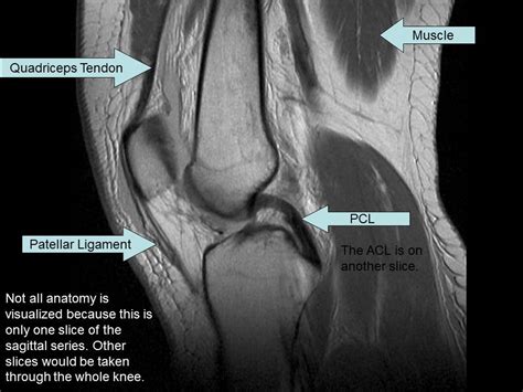 Magnetic Resonance Imaging - Knee Injury and Prevention