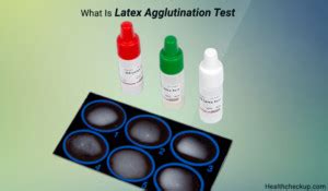 Latex Agglutination Test: Procedure, Principle,Types, Results Interpretation