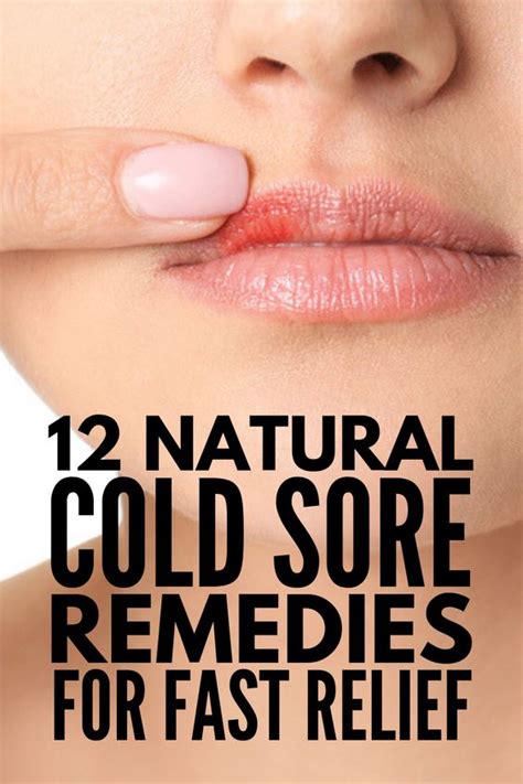 Fast and Effective: 12 Natural Cold Sore Remedies that Work - medicine ...