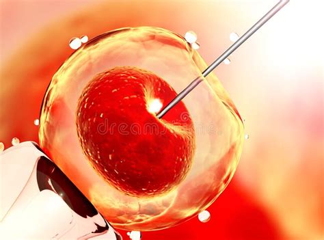 Artificial Insemination. Needle Puncture the Cell Membrane Stock Illustration - Illustration of ...