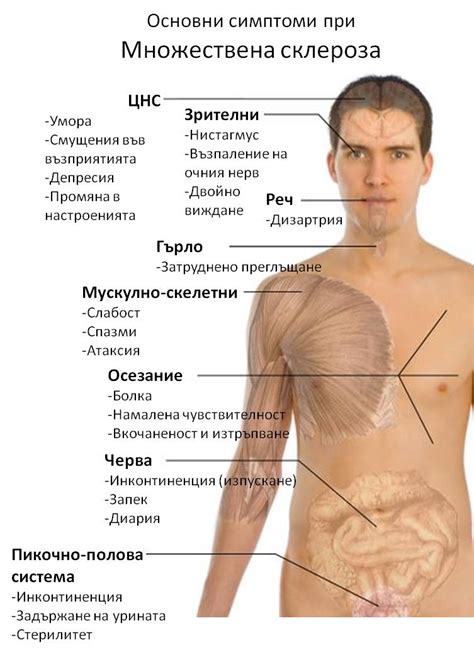 File:Symptoms of multiple sclerosis bg.jpg