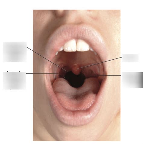 Anterior View of Faucial Pillars & Oral Cavity Landmarks Diagram | Quizlet