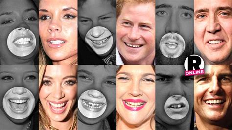 They May Be Beautiful But These Celebs Were Given A Bad Set Of Chompers