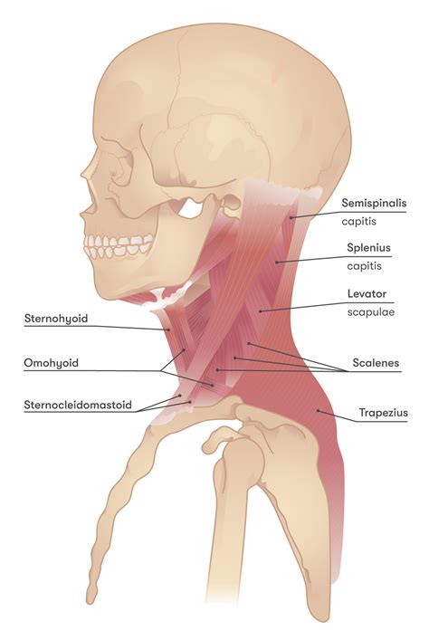 Neck Muscle Spasm