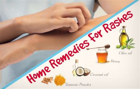 Top 24 Natural Home Remedies for Rashes on Body