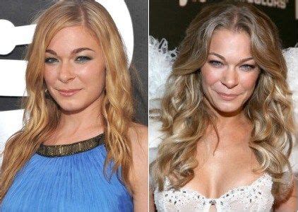 LeAnn Rimes Plastic Surgery Before and After - Celebrity Surgeries | Celebrity surgery, Plastic ...