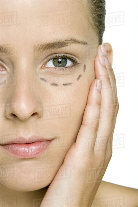 Woman with plastic surgery markings under eye, holding face, looking at camera, cropped - Stock ...