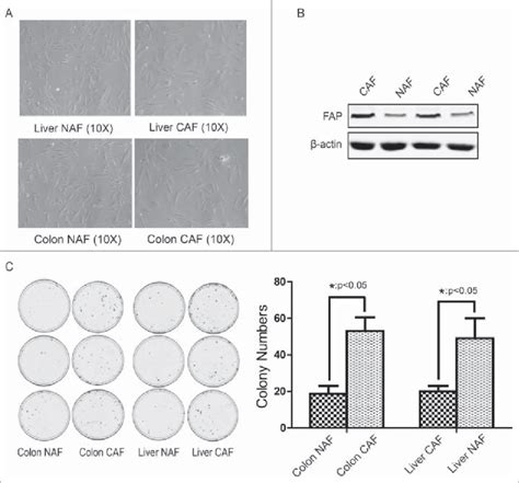 Isolation and identification of cancer-associated fibroblasts from... | Download Scientific Diagram