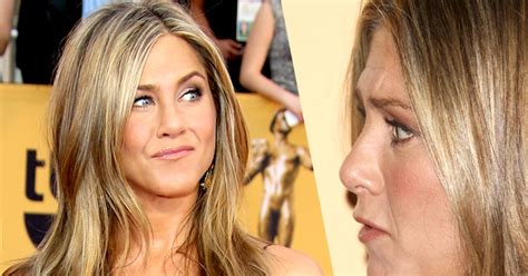 Jen Aniston's Surgery Secrets — She Gets Botox & Fillers, Docs Say