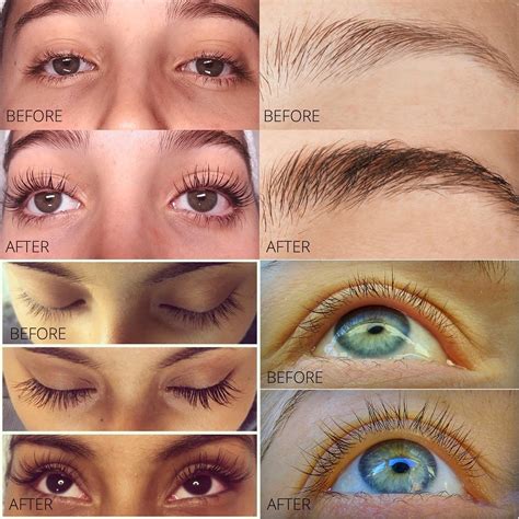 Eyelash and Eyebrow Serum Results