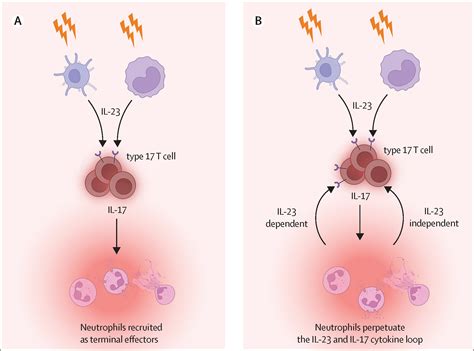 Role of neutrophil interleukin-23 in spondyloarthropathy spectrum ...