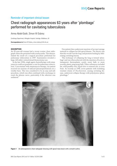 (PDF) Chest radiograph appearances 63 years after 'plombage' performed for cavitating tuberculosis
