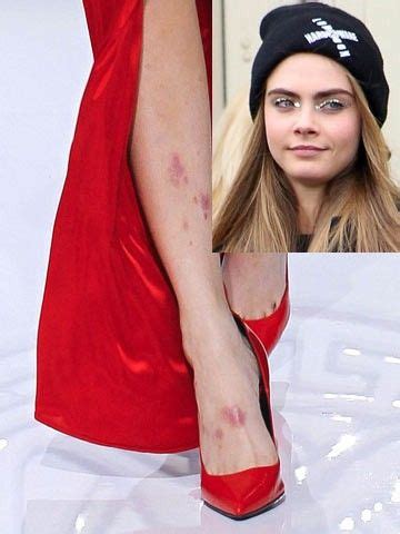 Amazing Makeup Transformation, Exfoliate Legs, Cara Delvingne, Princess Kate Middleton, Princess ...