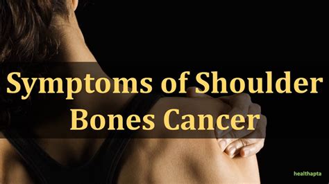 Symptoms of Shoulder Bones Cancer - YouTube