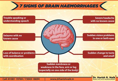 What Is A Hemorrhage, And What Signs Can Be Used To, 56% OFF