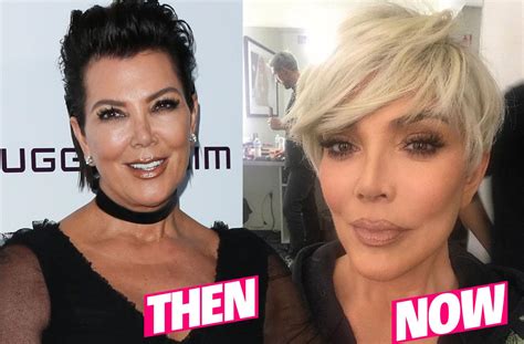 Kris Jenner Flaunts New Face After Plastic Surgery Makeover