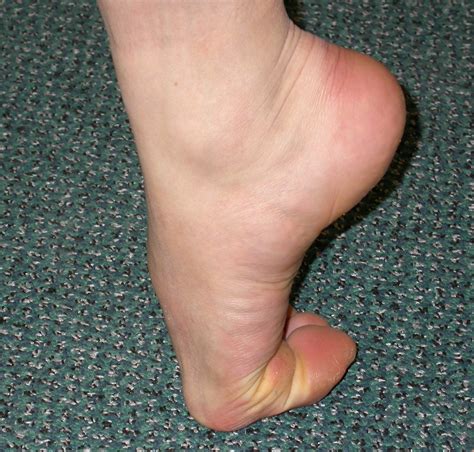 What Is Big Toe Joint Pain - Design Talk