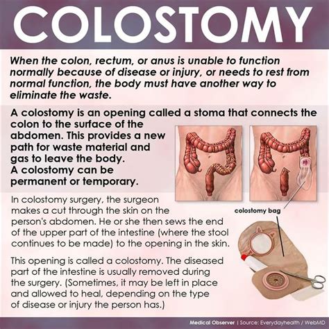 what is a colostomy? | Nursing tips, Colostomy, Health tips