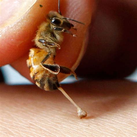 Bee Venom Therapy Photograph By Louise Murray/science Photo