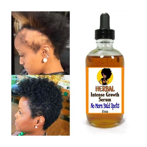 Fast Hair Growth Oil, Hair Growth Cream, Natural Hair Growth Oil, Longer Hair Growth, Natural ...