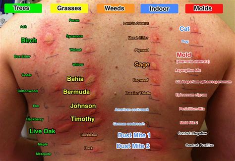 Identifying Skin Rashes In Adults