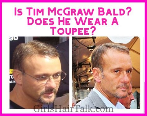 Is Tim McGraw Bald? Does He Wear A Toupee? Find Out!