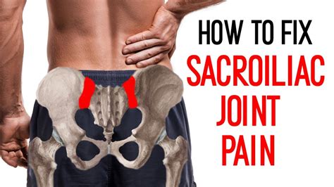 Sacroiliac Joint Pain - exercises for SI pain relief I Ask Your Pain ...