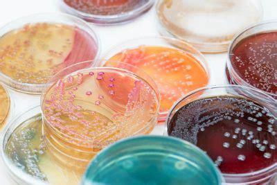 E coli - Microbiology Laboratories Australia