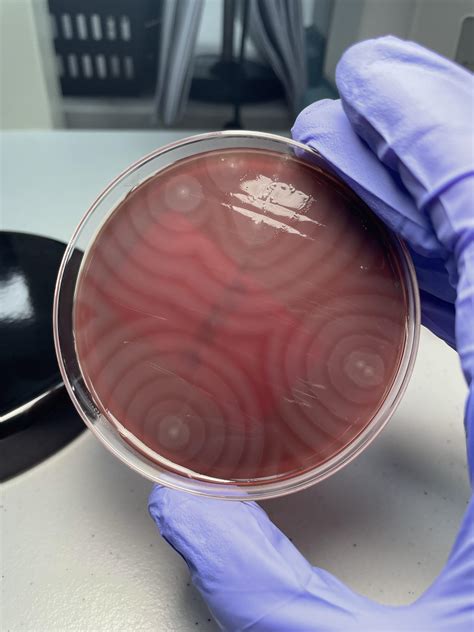 Proteus mirabilis swarm that I thought looked neat from today’s Urine cultures. : r/microbiology