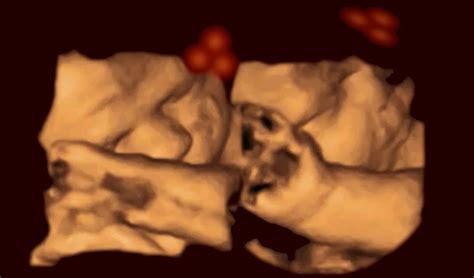 BRIEF: Babies in the Womb Look at Faces | Inside Science