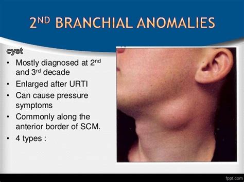 Branchial anomalies