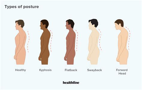 How to Achieve Good Posture - AISLAC