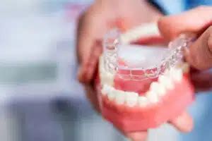 Can Invisalign Fix Crowding? Aligning Teeth Without Braces