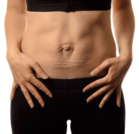 Experts On Diastasis Recti Course – Fit2B Studio | lupon.gov.ph