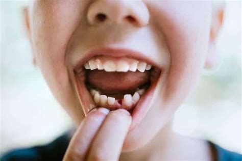 When Will My Child Lose Their First Tooth: A Guide to the 1st Tooth Fairy Visit - New Orleans ...