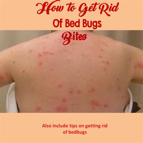 Infected Bed Bug Bites