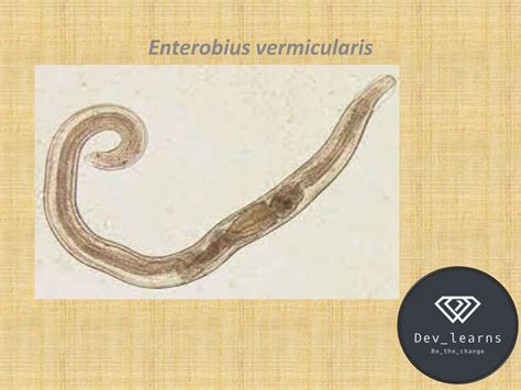 SOLUTION: Enterobius vermicularis- Life cycle-Morphology-Habit and ...