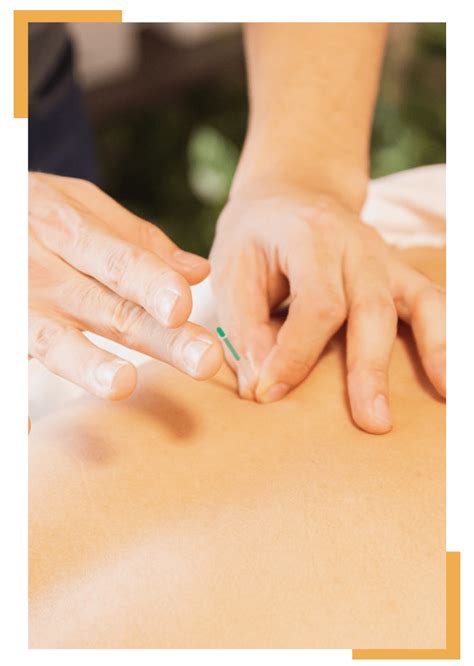 Dry Needling Physical Therapy and Its Benefits | OneRehab