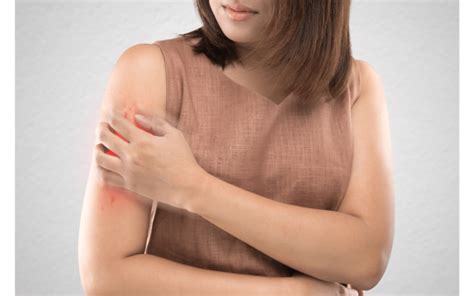 Psoriasis - Symptoms, Types, Causes or Treatment