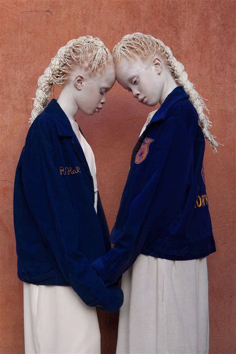 11-Year-Old Albino Twins Are Taking over the Fashion World | Albino ...