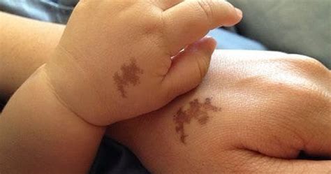 The Shape Of Your Birthmark Could Reveal A Hidden Message About Your Past