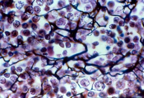 Reticular connective tissue | Microscopic cells, Loose connective tissue, Tissue types