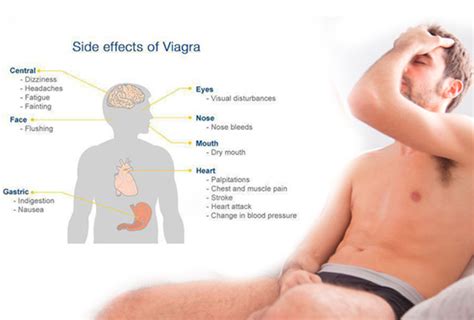 Serious side effects of Viagra on body - OrissaPOST