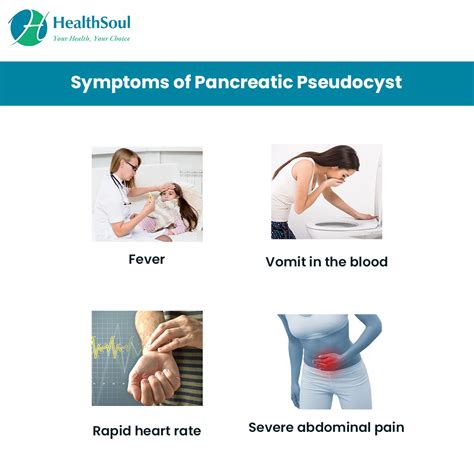 Pancreatic Pseudocyst: Symptoms, Causes and Treatment | Gastroenterology | HealthSoul