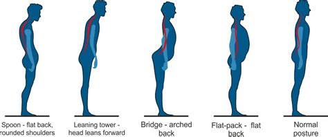 Straighten Up on World Spine Day - British Chiropractic Association