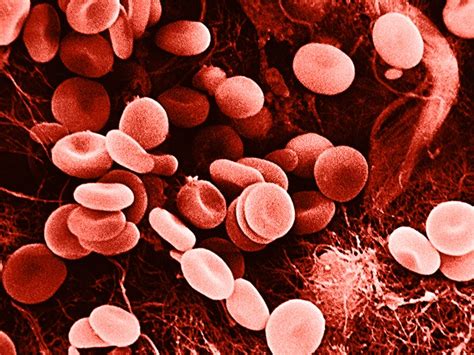 Red blood cell disorders: Types, causes, and symptoms